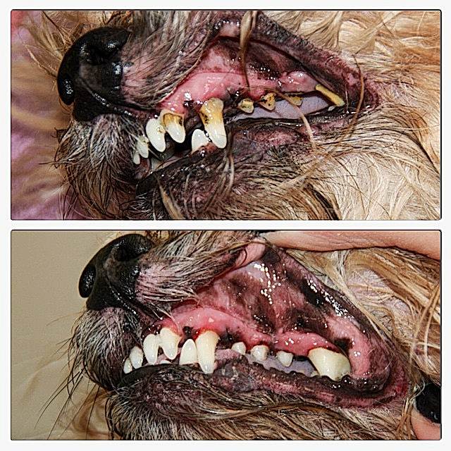 Чистка зубов ультразвуком